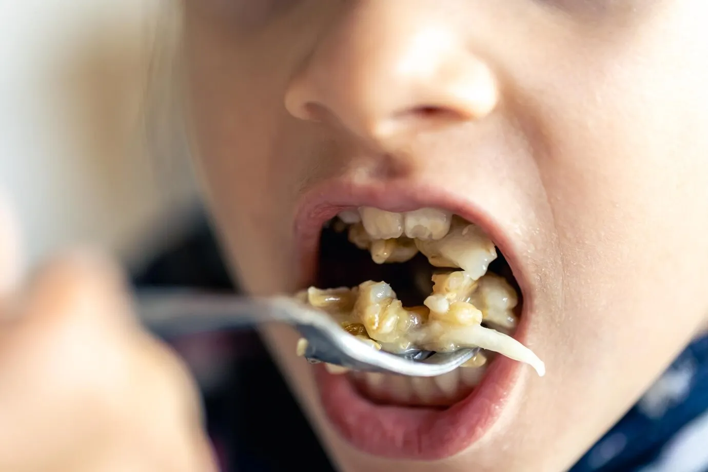 Teeth with food deposits